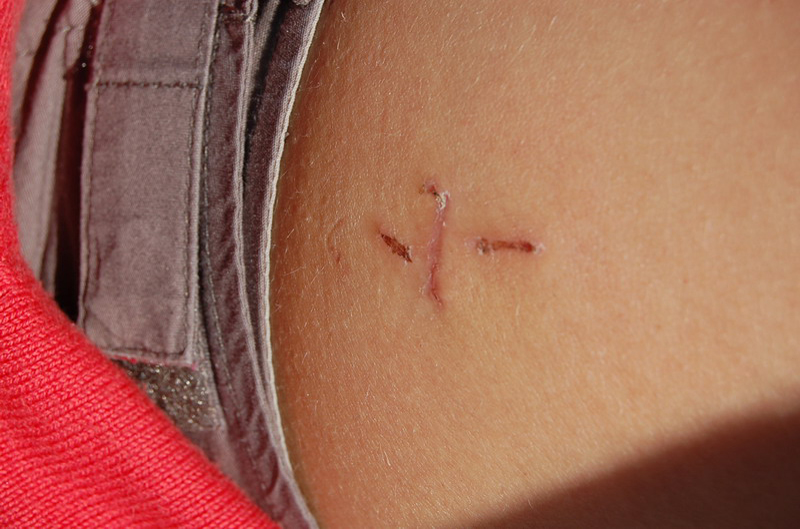 121308 Temuco-Pucón 8x6 010